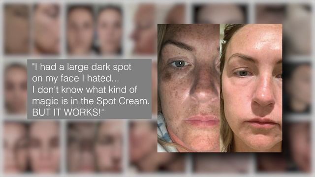 Musely FaceRx Featured on WE TV! | #melasma Treatment At Home смотреть онлайн