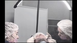 ДЕНИС БОЙМ Пересадка волос методом Fue 20.01.2025