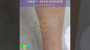 Нано абразивный депилятор ОГО