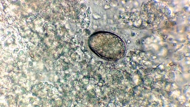 Cryptocaryon irritans смотреть онлайн