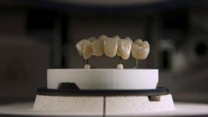 IPS e.max ZirCAD Prime – Redefining all-ceramics