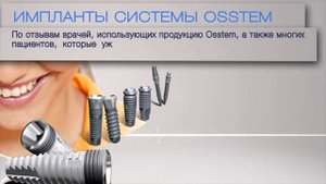 Денталь  импланты Osstem