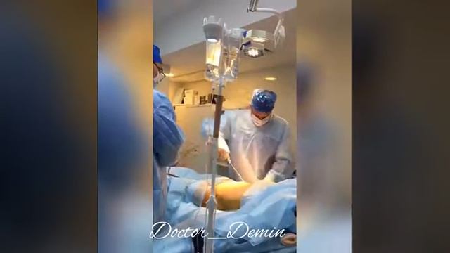 Видео одного из этапов проведения липосакции, Демин Сергей смотреть онлайн