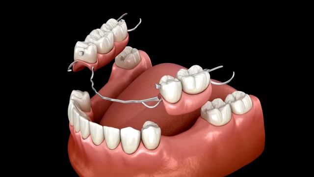 نزيف اللثه عند تنظيف الاسنان \ التهاب اللثه وعلاجها \ جير الاسنان смотреть онлайн
