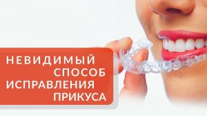 Исправление прикуса: комфортно и незаметно с помощью элайнеров. Невидимые элайнеры. Симпладент. 12+