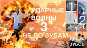 Основная причина разрушения передних зубов - Кариес и периодонтит резцов - Ударные волны 3