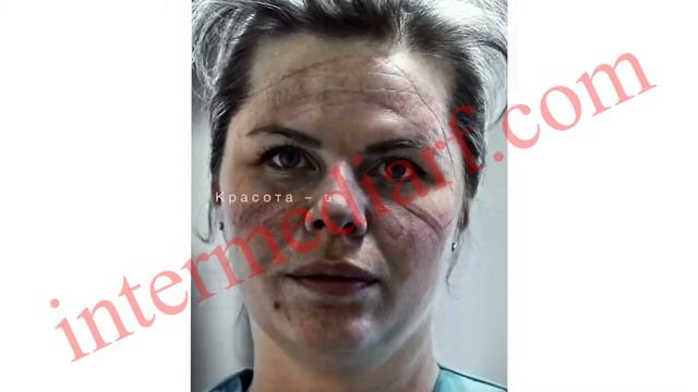 Красота — в мужестве: Dove выпустил ролик с фотографиями медиков после смены