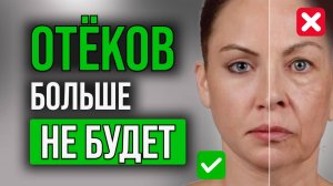 ПОЧЕМУ вас мучают ОТЁКИ? Продукты, которые УБЕРУТ отеки НАВСЕГДА