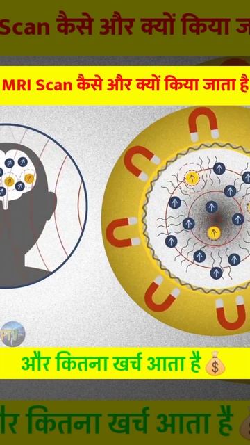 MRI Scan क्या होता है और क्यों किया जाता है 🤔#shorts #knowledgeable #thefactztv