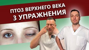 Упражнения от птоза верхнего века / Что такое птоз / Как убрать птоз / опущение верхнего века