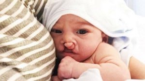 Над этим ребенком все издевались. Вот как он выглядит сегодня…