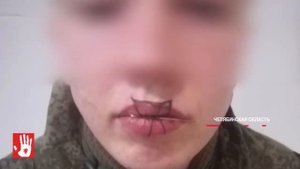 «На службу не жалуется». Челябинский омбудсмен встретилась с солдатом, который зашил себе рот