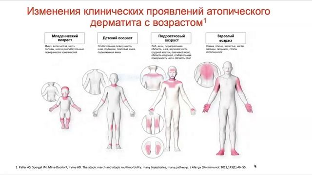 Спикер школа Практические вопросы дерматовенерологии с позиции клинических рекомендаций 20.10.2020