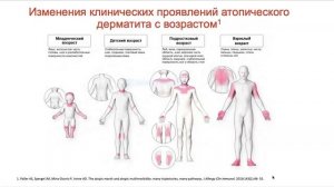 Спикер школа Практические вопросы дерматовенерологии с позиции клинических рекомендаций 20.10.2020