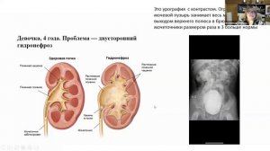 29.01.2025. Встреча с Верой Крылатовой