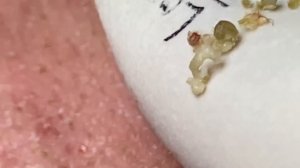 Enjoy Every Day With The Best Video Loan Nguyen Spa Official  2319