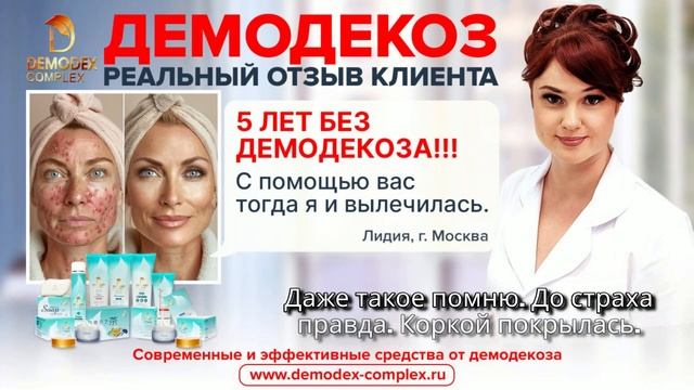 Демодекоз у меня был 5 лет назад. Тогда с помощью вас я и вылечилась #демодекс #демодекоз