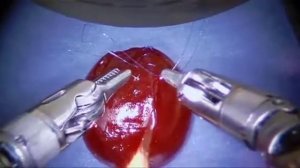 Робот хирург!? операция на плоду винограда