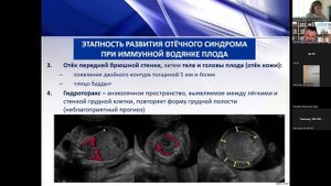 Современные направления ультразвуковой диагностики. Вебинар 08.11.2022