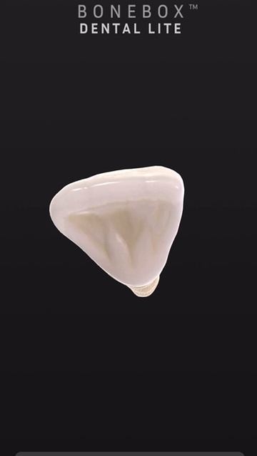 3D модель строения зубного аппарата человека в приложении «BoneBox-Dental Lite»