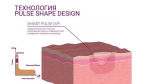 SMARTXIDE PUNTO