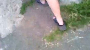 Мне разрезали ногу