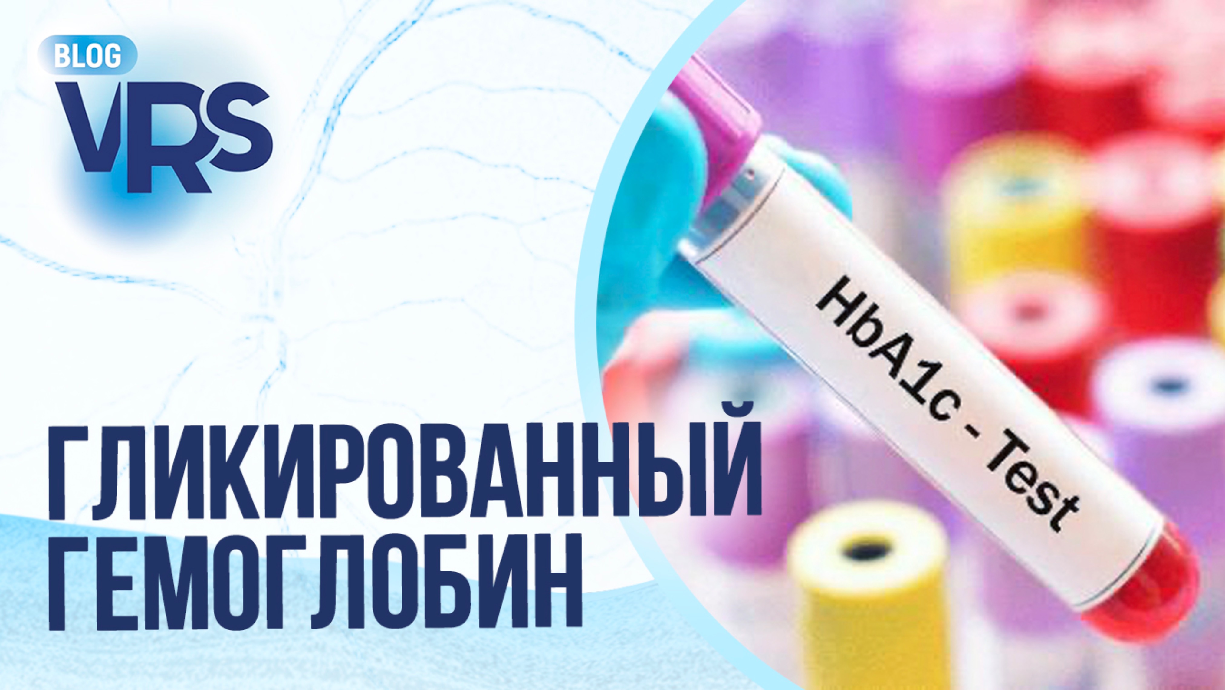 Сахарный диабет / Диабетическая ретинопатия / Гликированный гемоглобин