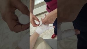 Бинтование кисти для пациентов с лимфостазом руки