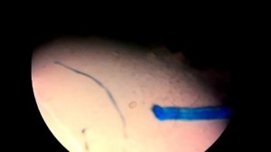 paragonimus westermani egg