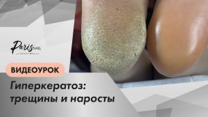 ВИДЕОУРОК педикюр дисками от ParisNail: работа со сложной стопой.