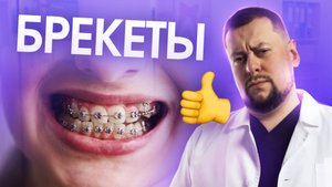 Всё о брекетах