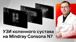 Техника сканирования коленного сустава на Mindray Consona N7