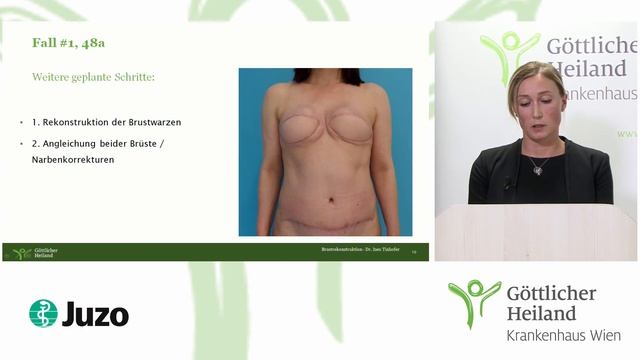 Webinar Plastische Chirurgie Vortrag 2: Lymph & Postmastektonie