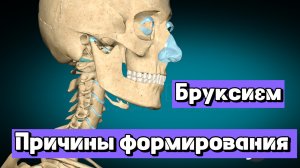Бруксизм. Причины формирования