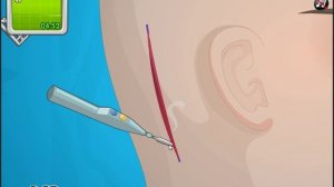 симулятор хирурга;делаем операцию на ухо