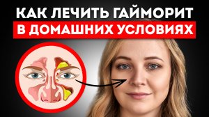 Как Распознать Гаморит: Причины, Симптомы, Лечение