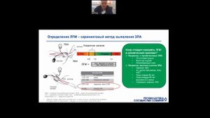 Мультифокальный атеросклероз у пациентов с ИБС  На что обратить внимание в диагн