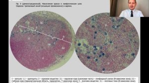 ОРГАНЫ КРОВЕТВОРЕНИЯ И ИММУНОГЕНЕЗА (ГИСТОЛОГИЧЕСКИЕ ПРЕПАРАТЫ)