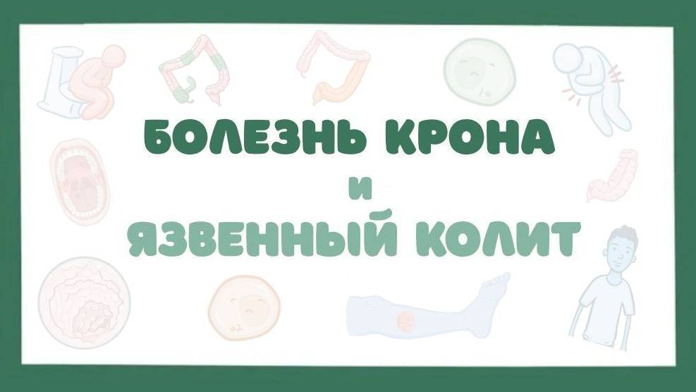 Болезнь Крона, Язвенный колит - причины, симптомы, лечение (лекция)