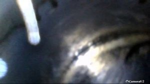 Эндоскопия