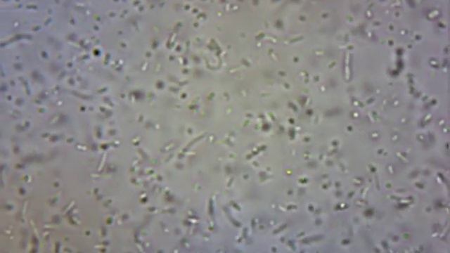 Multitud de bacterias смотреть онлайн