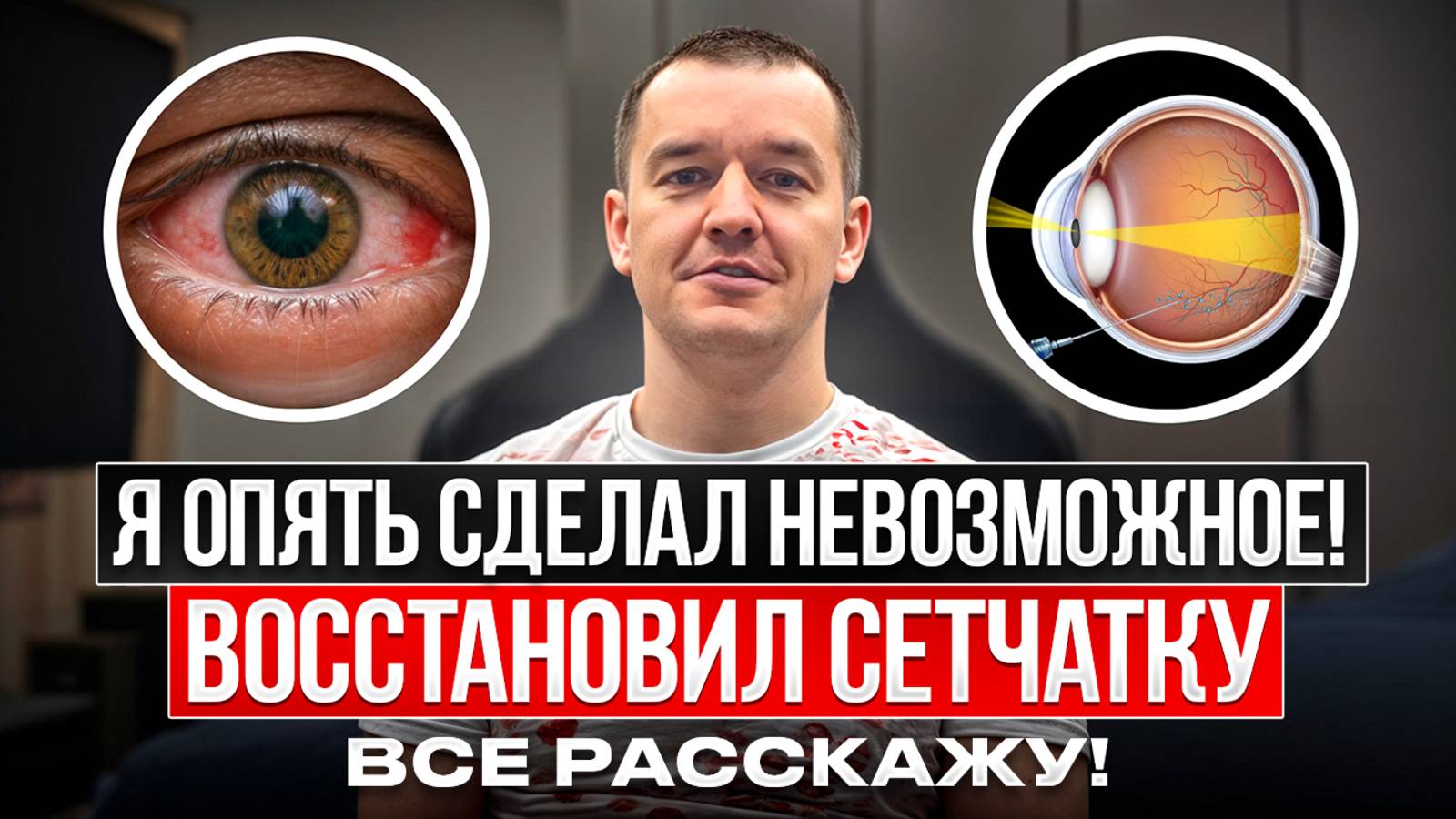 Я опять сделал невозможное! Восстановил сетчатку, все расскажу!