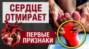 Как Лечить Ноги⭕Судороги в Ногах Причины и Решение⭕ Острое нарушение мозгового кровообращения