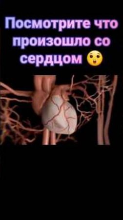 Алкоголь против сердце 🍾🫀