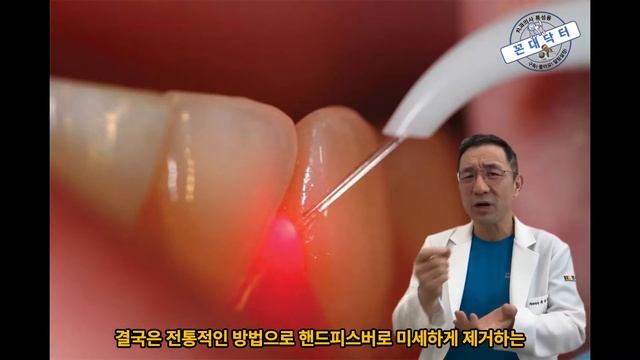 치아는 하얗게 치아미백으로, 잇몸은 선홍색으로 잇몸미백으로 효과 탁월한 잇몸미백 강추합니다