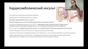 Кровоснабжение головного мозга. Ишемический инсульт и ТИА. Часть 1.