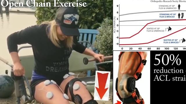 Protected Open Chain Exercise ACLR post op with 4-point-of-leverage ACL Brace смотреть онлайн