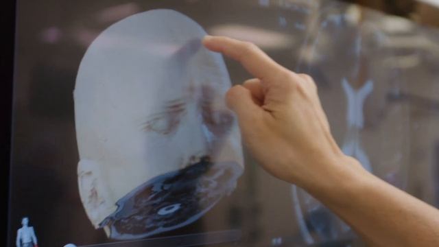 Intraoperative Magnetic Resonance Imaging (iMRI)