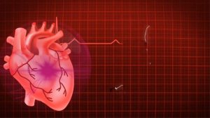 Что такое Сердечная недостаточность?