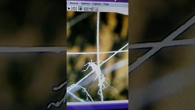 Coccidioides immitis at work in hair. смотреть онлайн